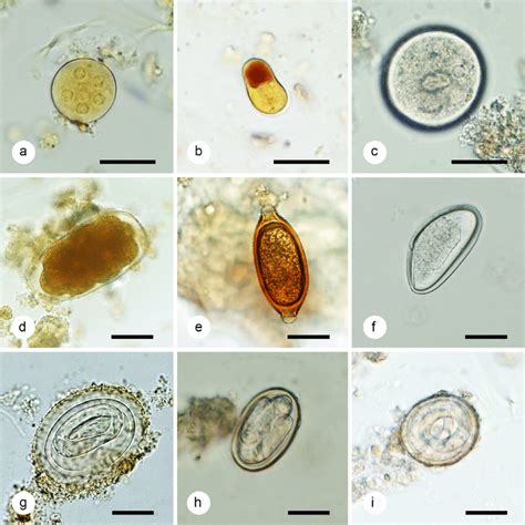 protozoan cysts are functionally similar to